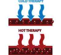 When to Use Cold vs. Heat